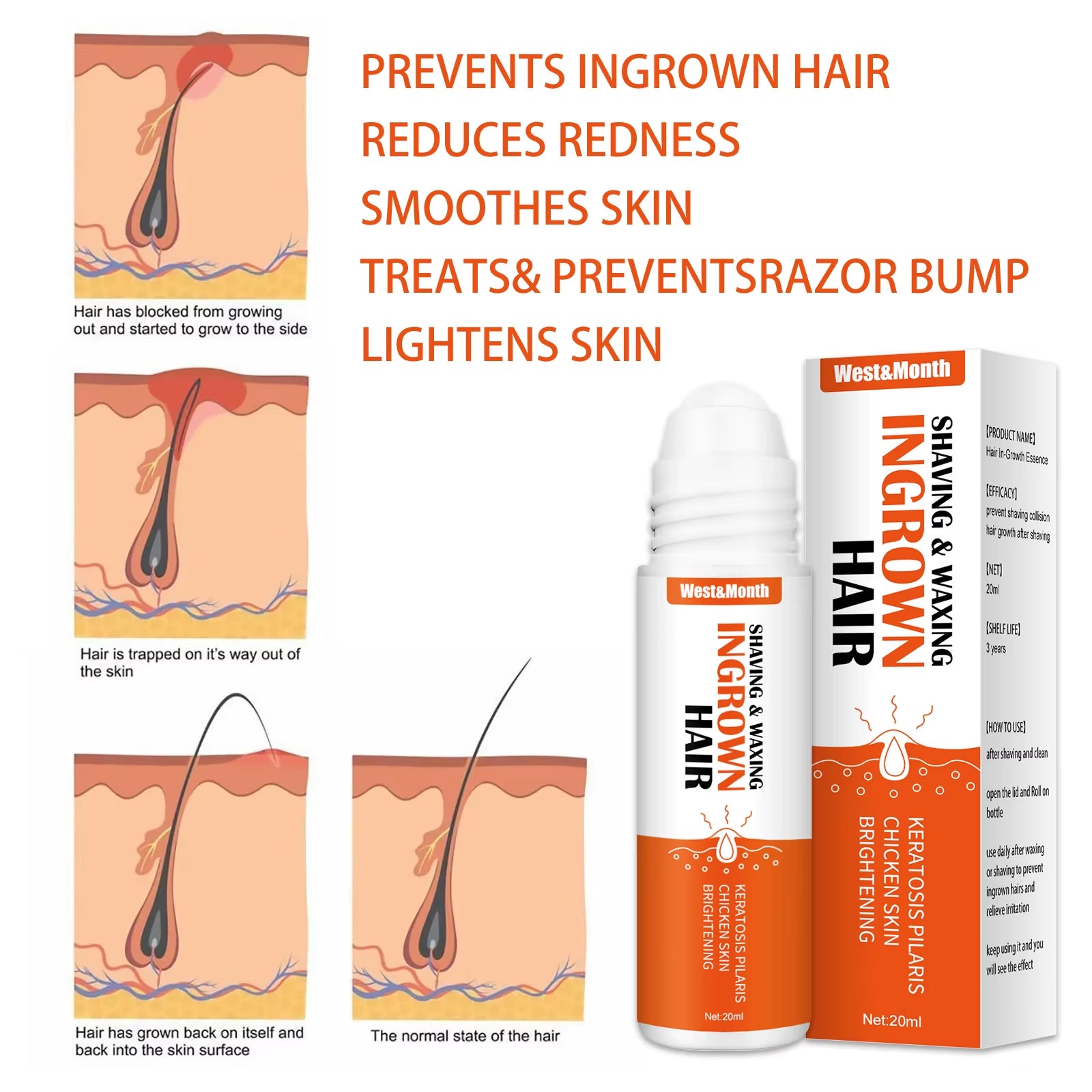 Ingrown Hairs Treatment after Shave Repair Serum Solution Dark Spot Reduce Redness for Vanish Pfb Skin Care Prevent Razor Bumps
