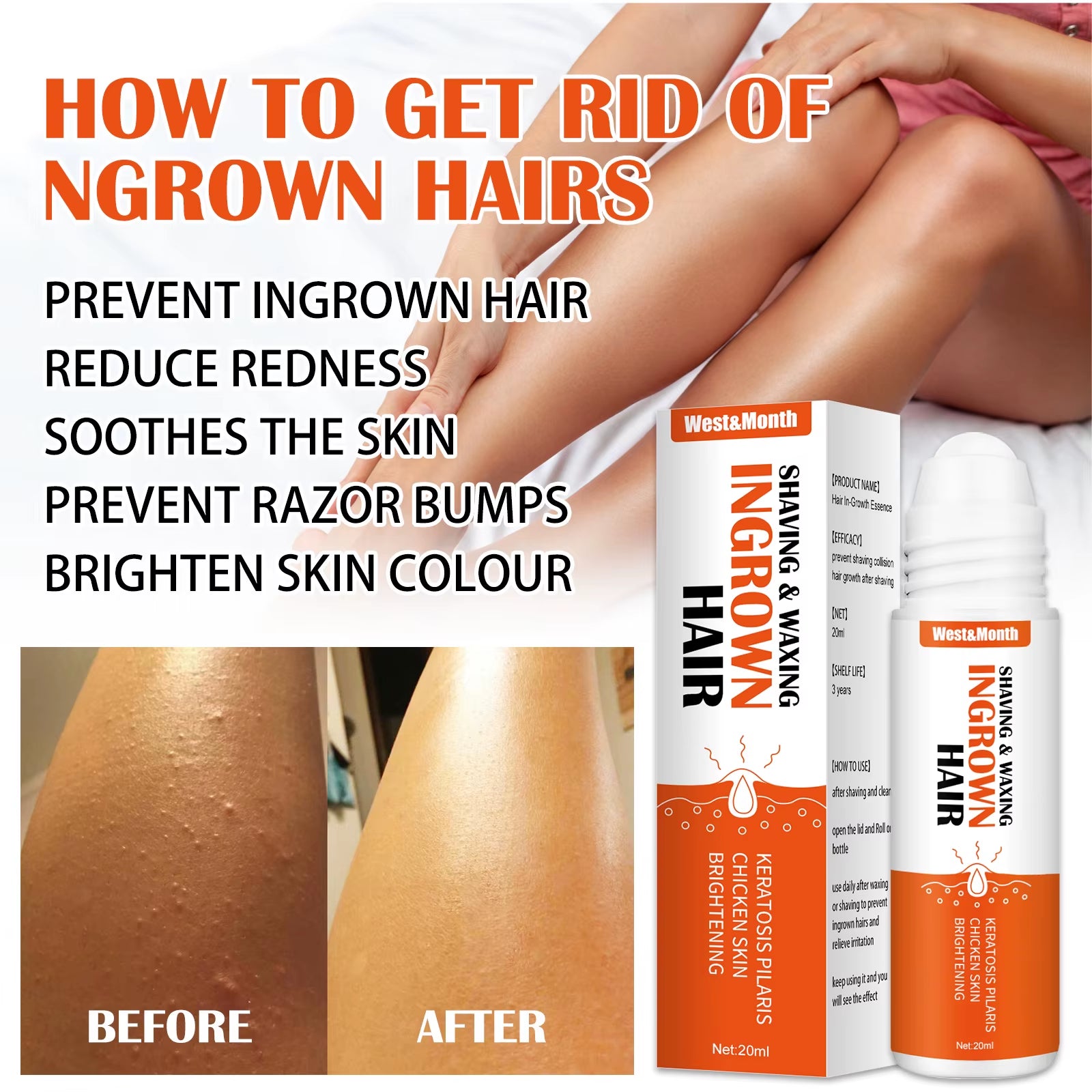 Ingrown Hairs Treatment after Shave Repair Serum Solution Dark Spot Reduce Redness for Vanish Pfb Skin Care Prevent Razor Bumps