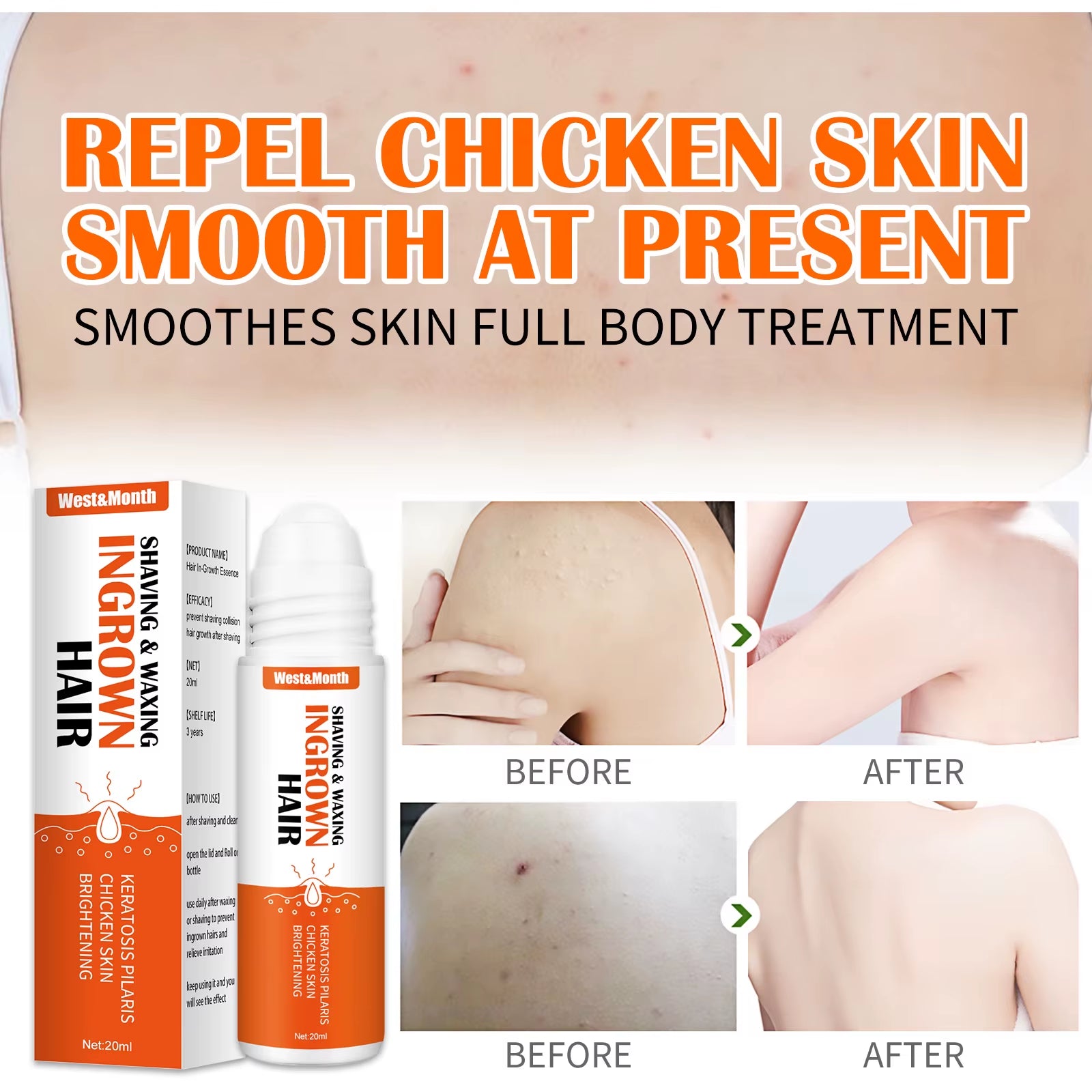 Ingrown Hairs Treatment after Shave Repair Serum Solution Dark Spot Reduce Redness for Vanish Pfb Skin Care Prevent Razor Bumps